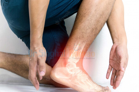 Osteomyelitis Treatment in Homeopathy at Best Cost